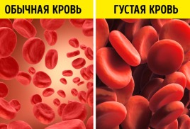 Правда ли, что кровь "густеет" от недостатка воды?